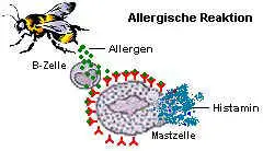 Massenhafte Ausschttung von Histamin bei allergischer Reaktion vom Typ 1.