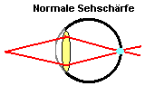 Normale Sehschrfe