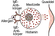 Allergische Quaddelbildung durch Histaminausschttung der Mastzellen.