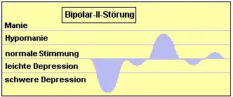 Phasen der Bipolar-II-Strung