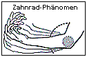 Das Zahnrad-Phnomes beschreibt ruckartige Bewegungen.