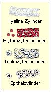 Beispiele fr Zylinder